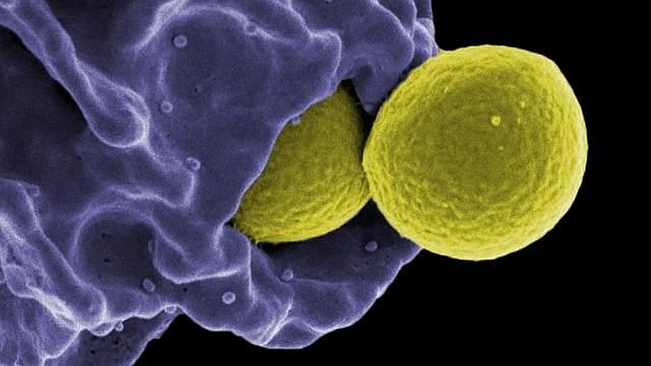 MRSA engulfed