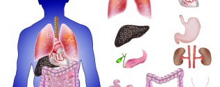 Bioprinting organs