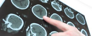 Neuromedicine